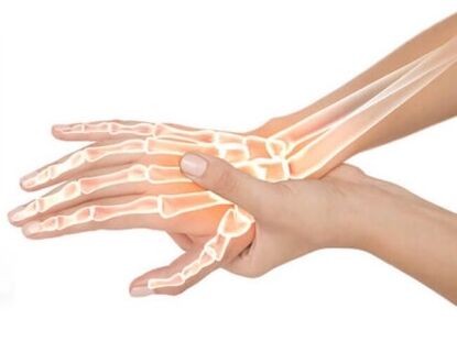 Se aplica Hondrox al área afectada