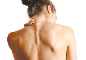 Cómo se manifiesta la osteocondrosis cervical