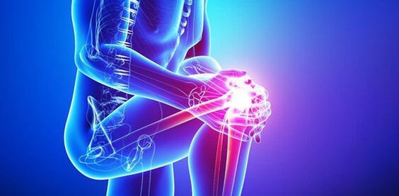 dolor severo en la articulación de la rodilla