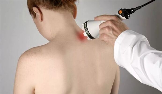 fisioterapia para el tratamiento de la osteocondrosis cervical